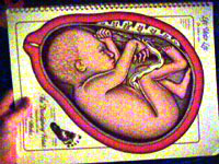 Foetus &agrave; 34 semaines